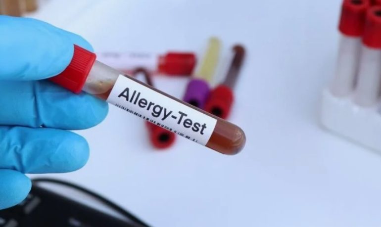Какие продукты чаще всего вызывают аллергию: разбор результатов пищевой панели